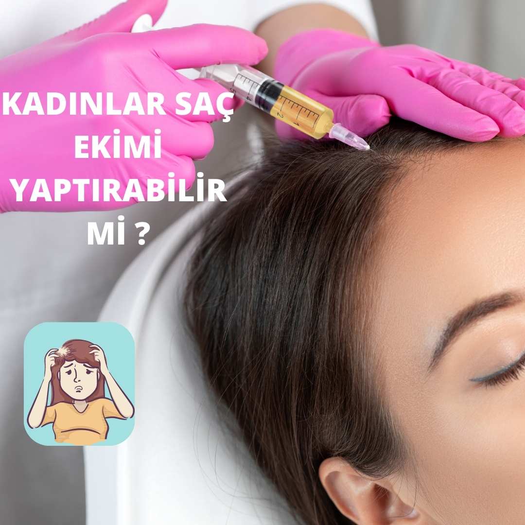 Kadınlar Saç Ekimi Yaptırabilir Mi?