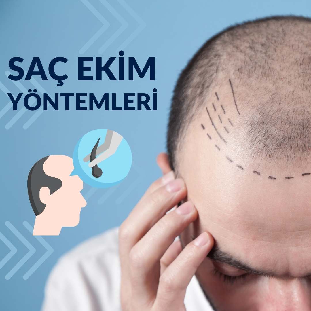 Saç Ekim Yöntemleri