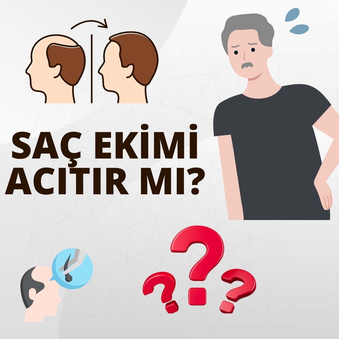 Saç Ekimi Acıtır mı?