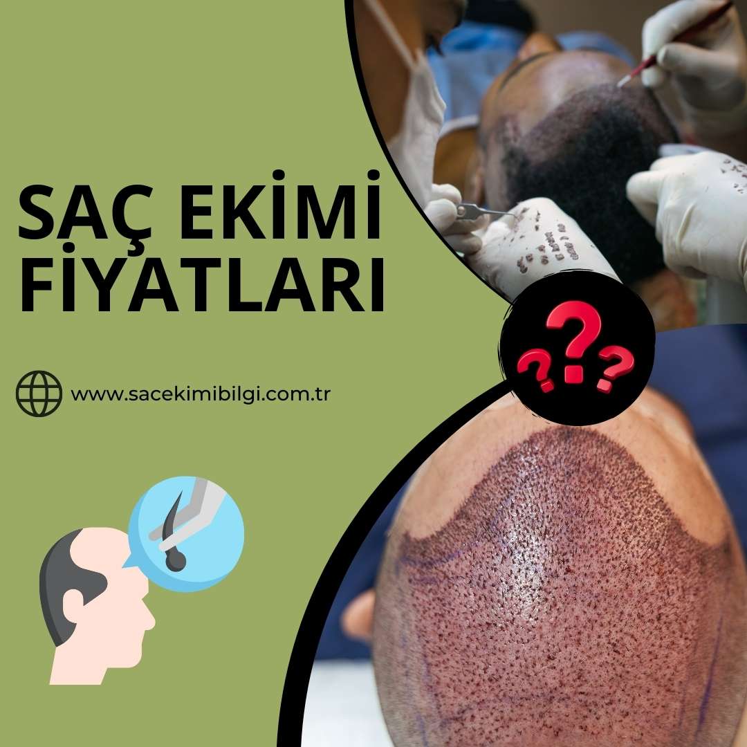 Saç Ekimi Fiyatları