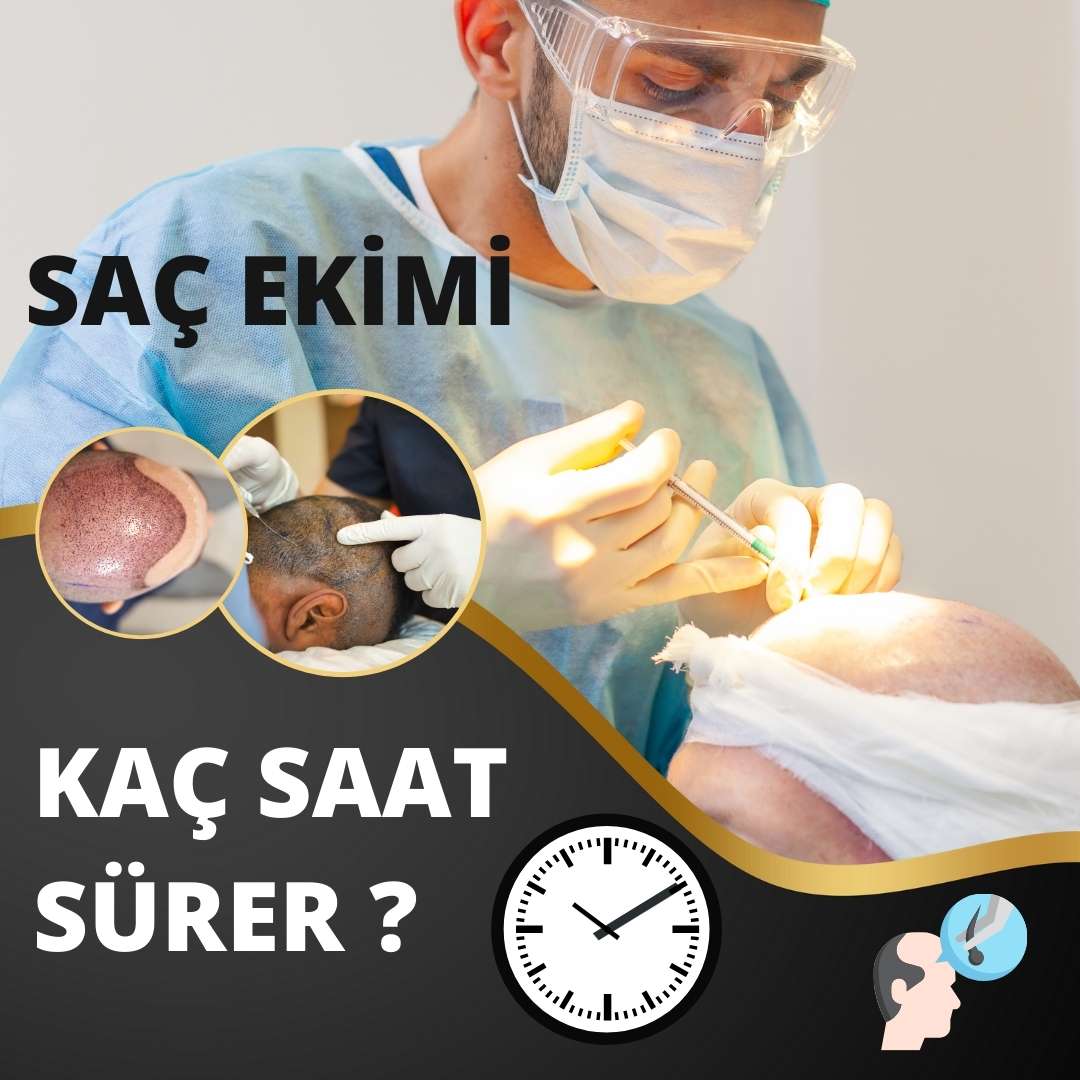 Saç Ekimi Kaç Saat Sürer ?