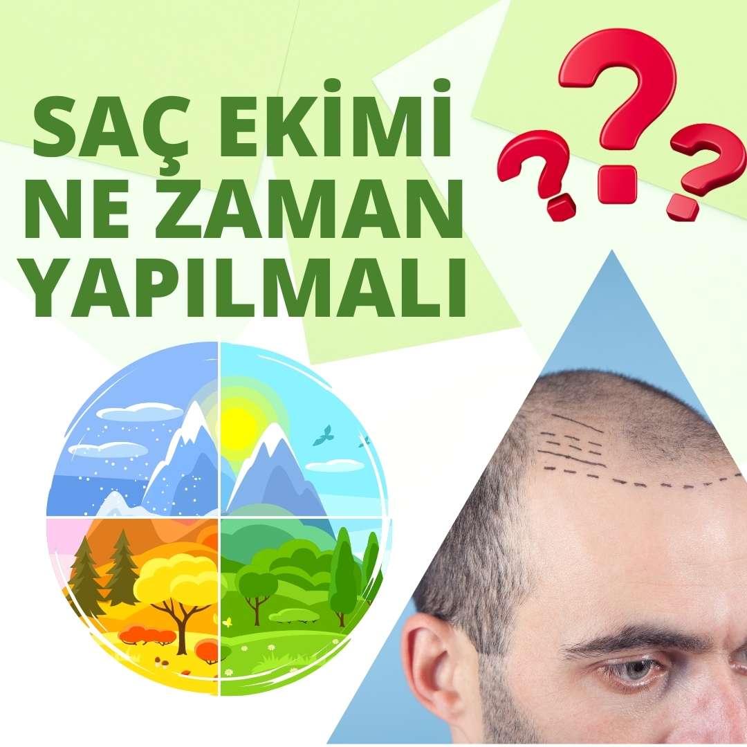 Saç Ekimi Ne Zaman Yapılmalı ?