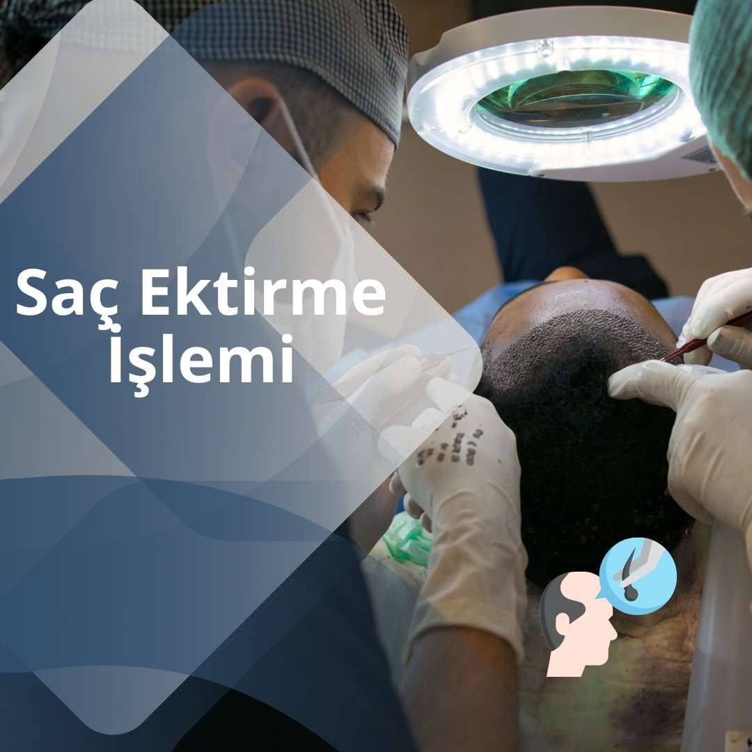 Saç Ektirme İşlemi