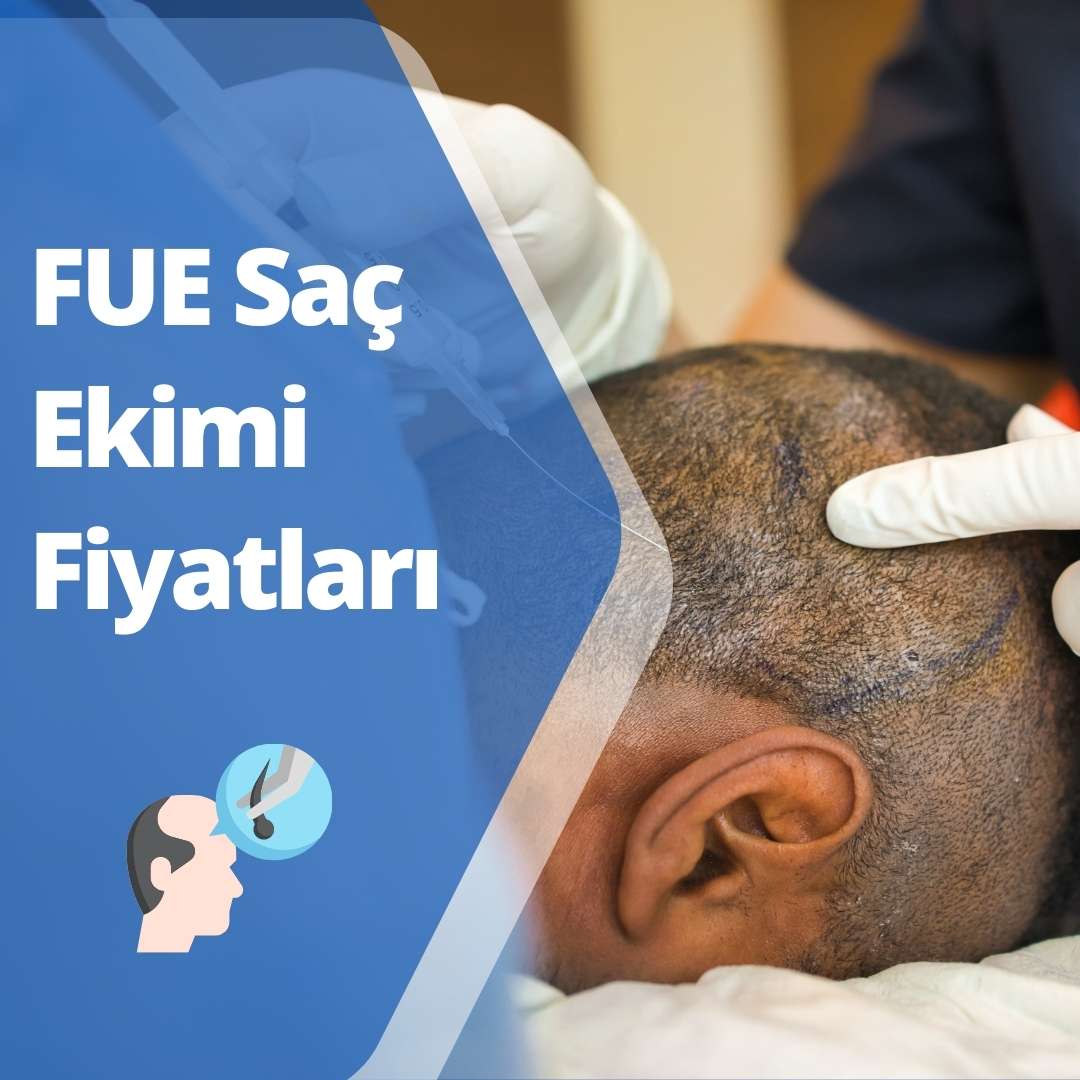 FUE Saç Ekimi Fiyatları