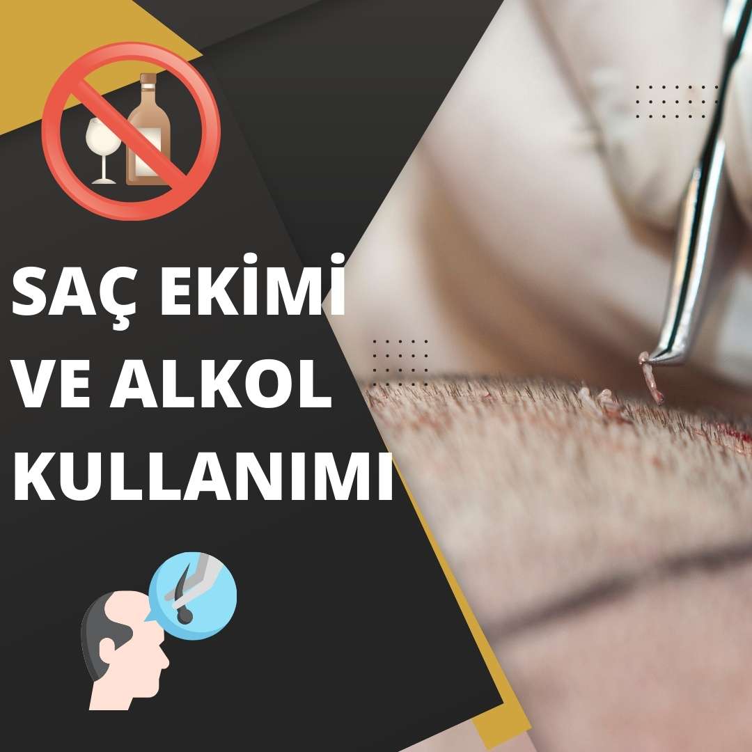 Saç Ekimi ve Alkol Kullanımı