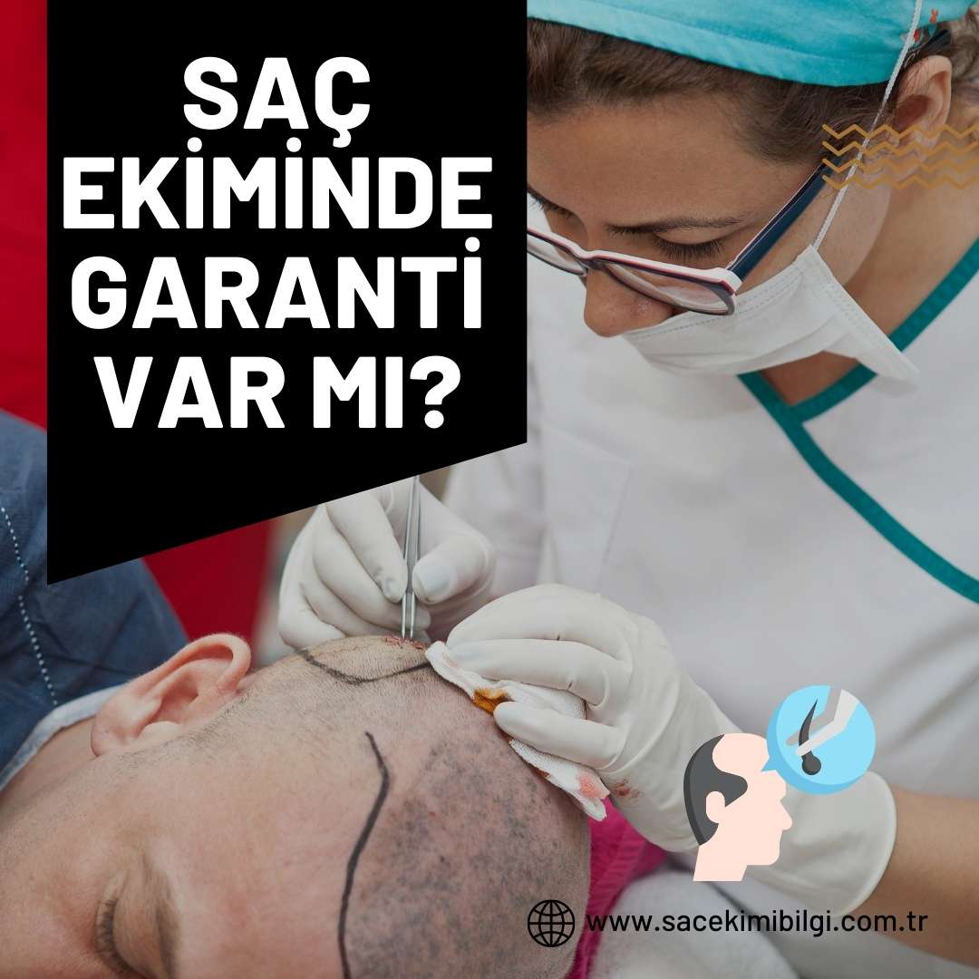 Saç Ekiminde Garanti Var Mı?