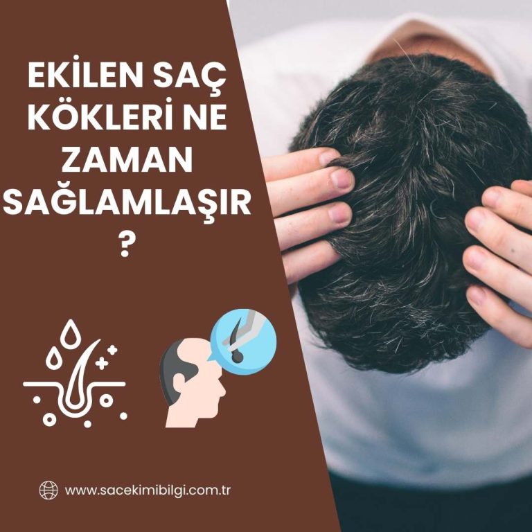 Ekilen Saç Kökleri Ne Zaman Sağlamlaşır ?