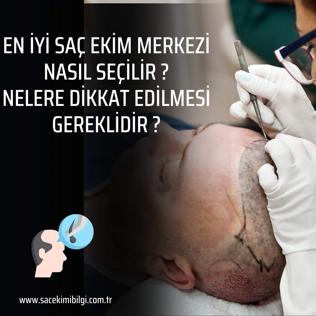 En İyi Saç Ekim Merkezi Nasıl Seçilir ?