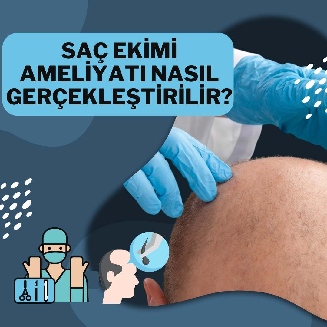 Saç Ekimi Ameliyatı Nasıl Gerçekleştirilir ?