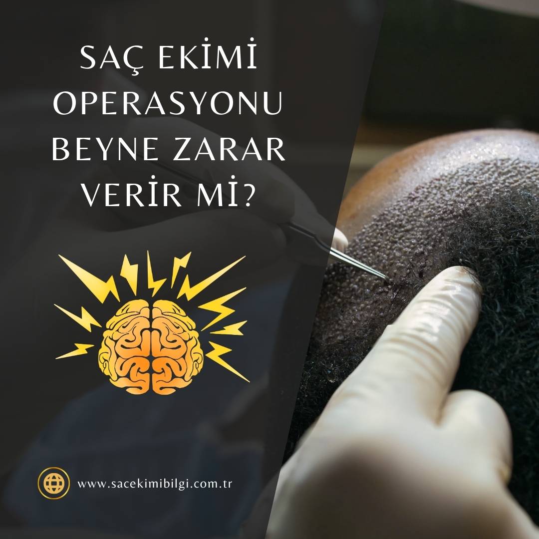 Saç Ekimi Beyne Zarar Verir Mi?