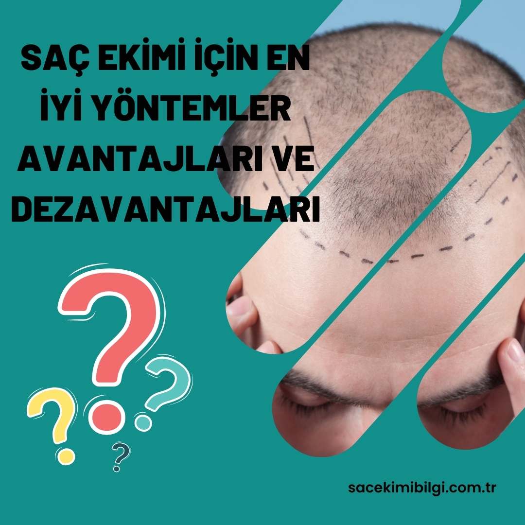 Saç Ekimi İçin En İyi Yöntemler ve Avantajları