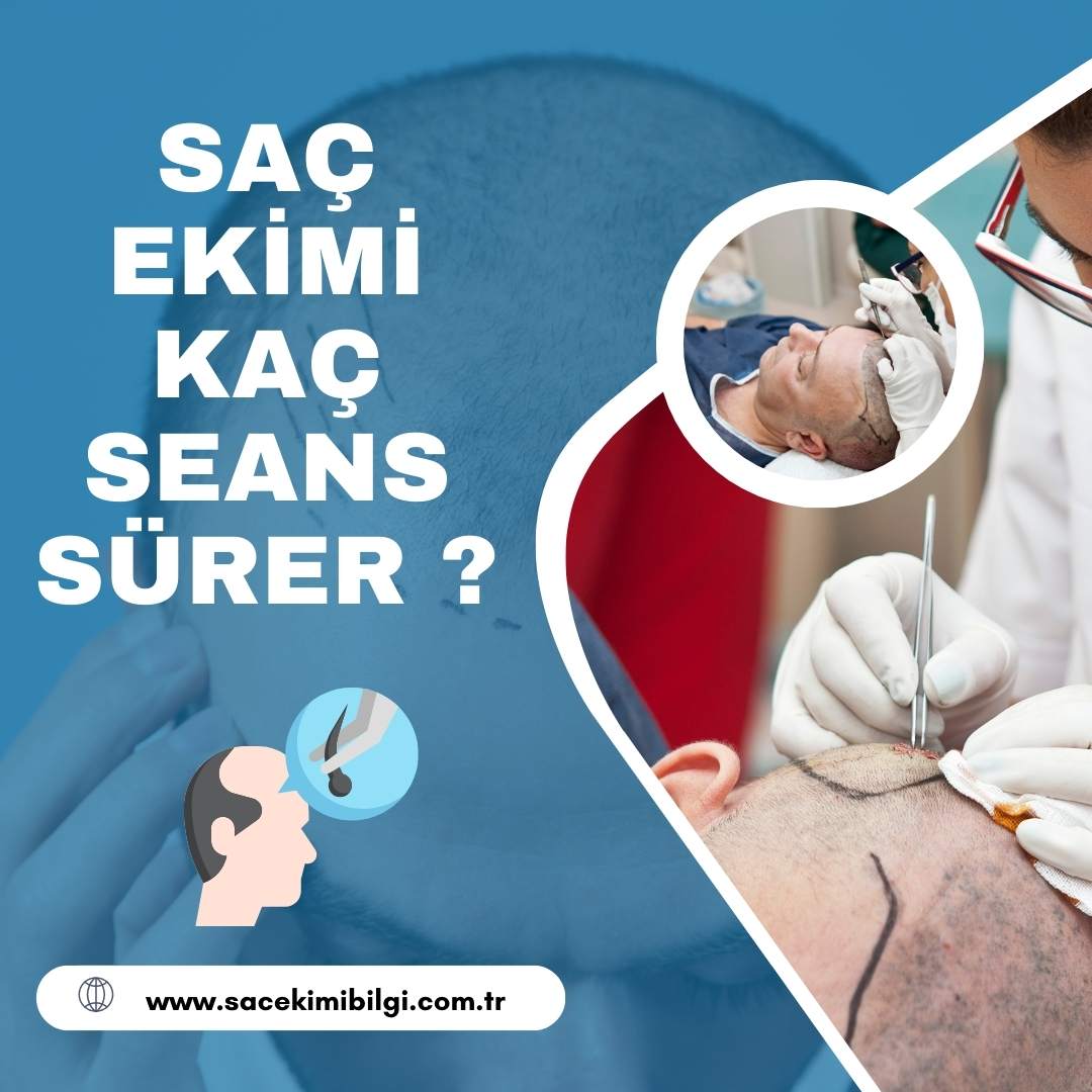 Saç Ekimi Kaç Seans Sürer ?