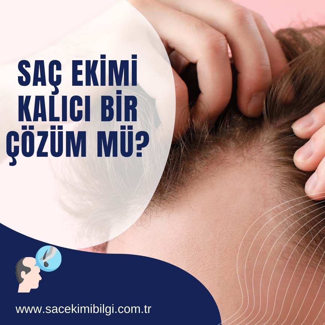 Saç Ekimi Kalıcı Çözüm mü