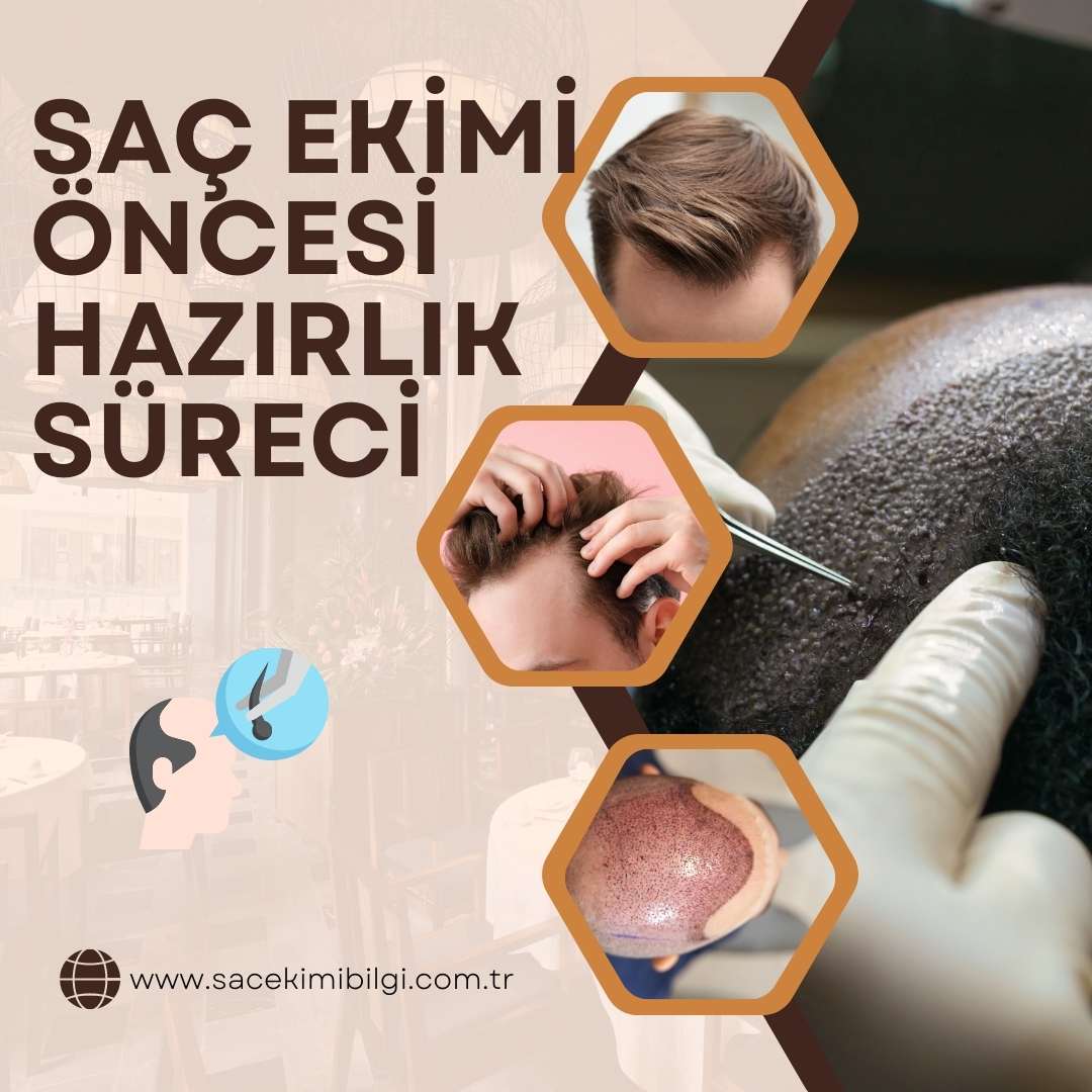 Saç Ekimi Hazırlık Süreci