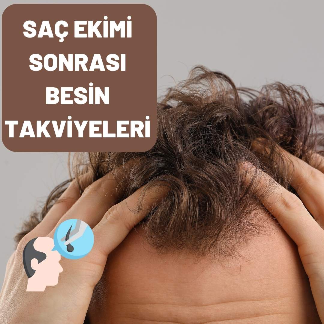 Saç Ekimi Sonrası Besin Takviyelerinin Önemi