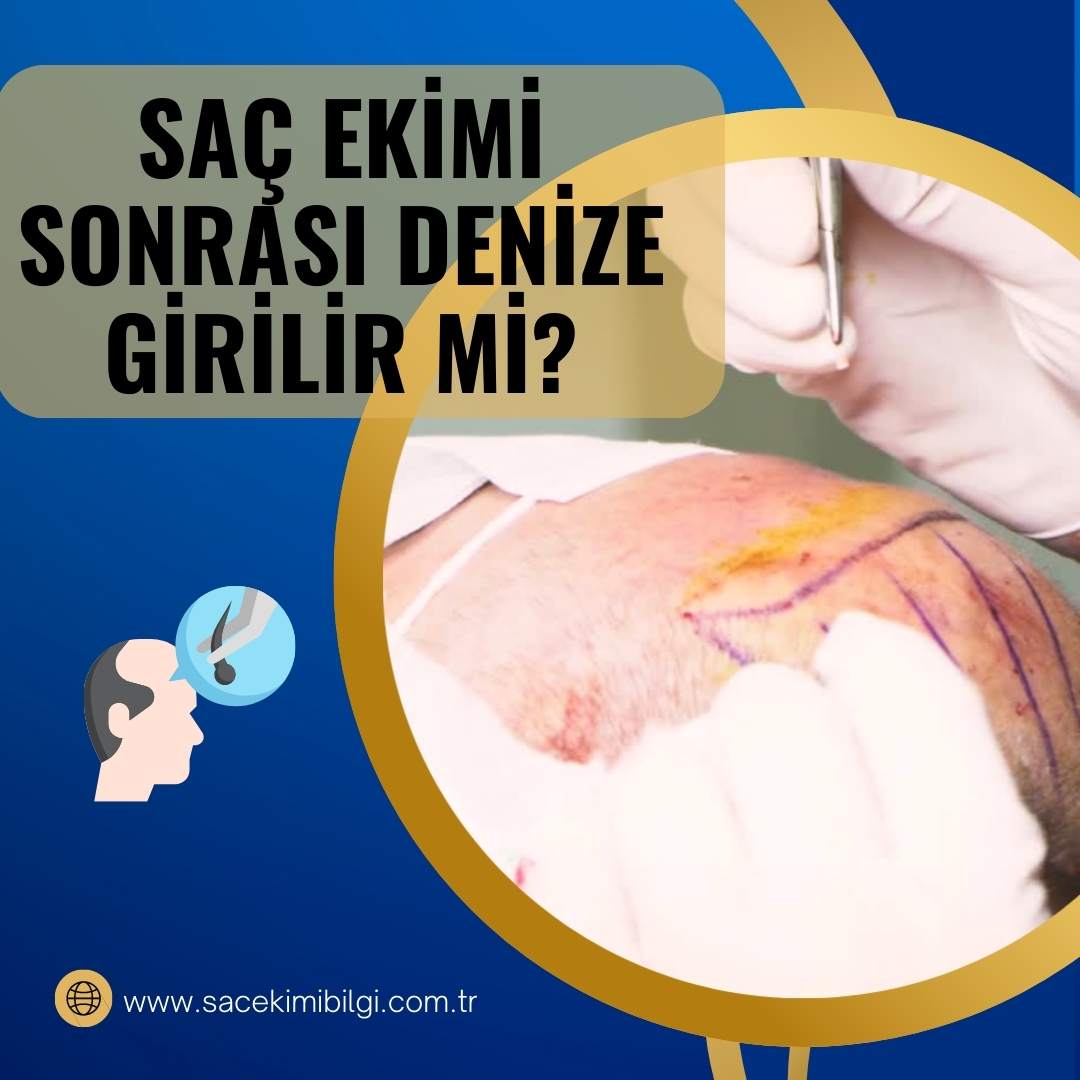 Saç Ekimi Sonrası Denize Girilir mi?