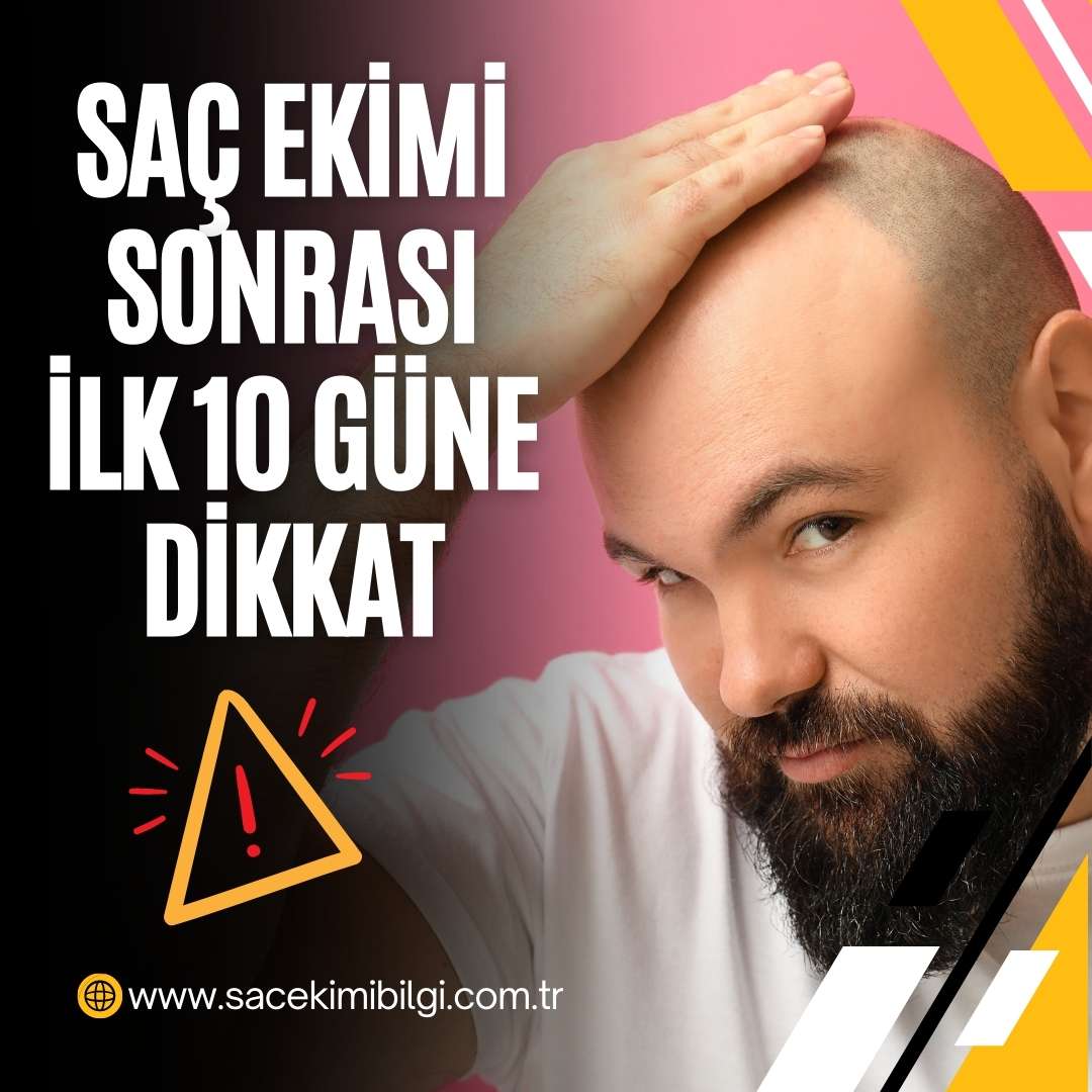 Saç Ekimi Sonrası İlk 10 Güne Dİkkat