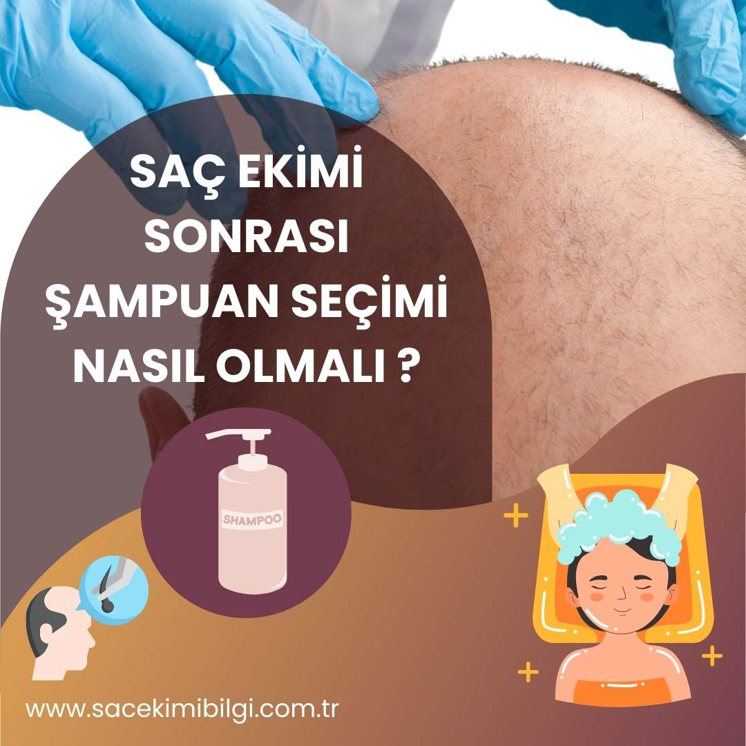 Saç Ekimi Sonrası Şampuan Seçimi Nasıl Olmalı ?