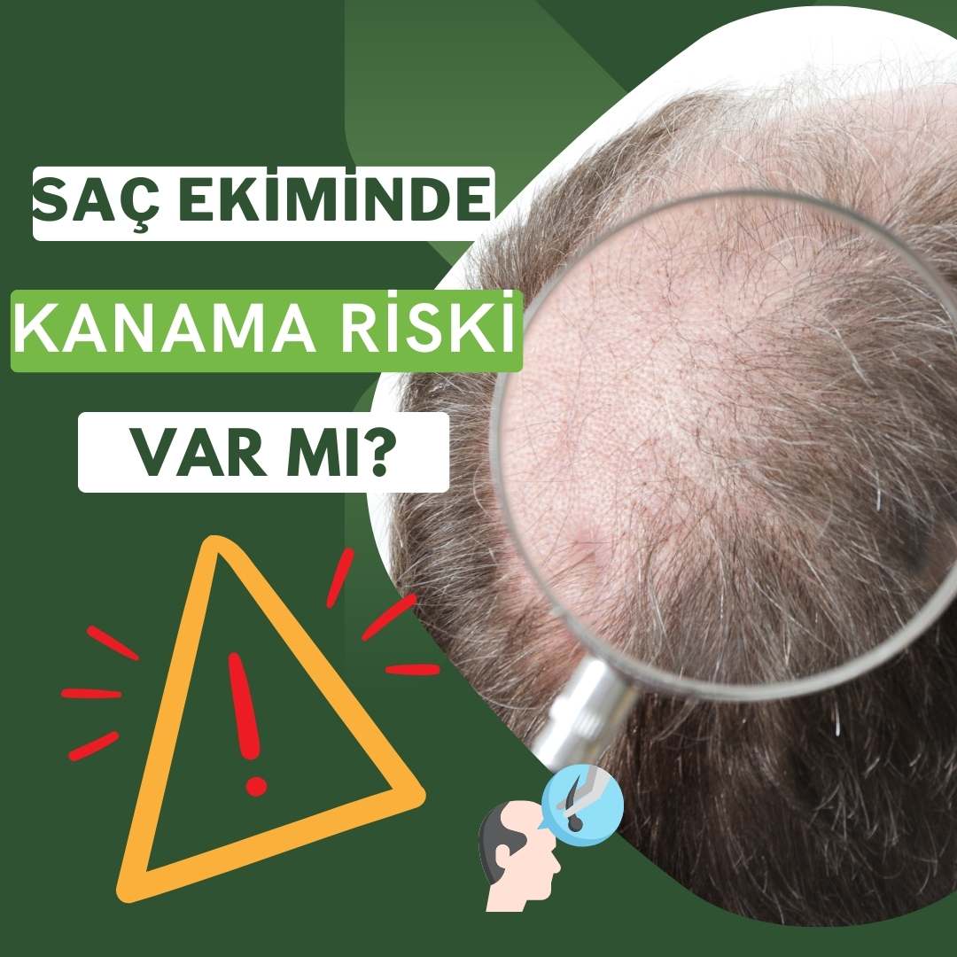 Saç Ekiminde Kanama Riski Var Mı?