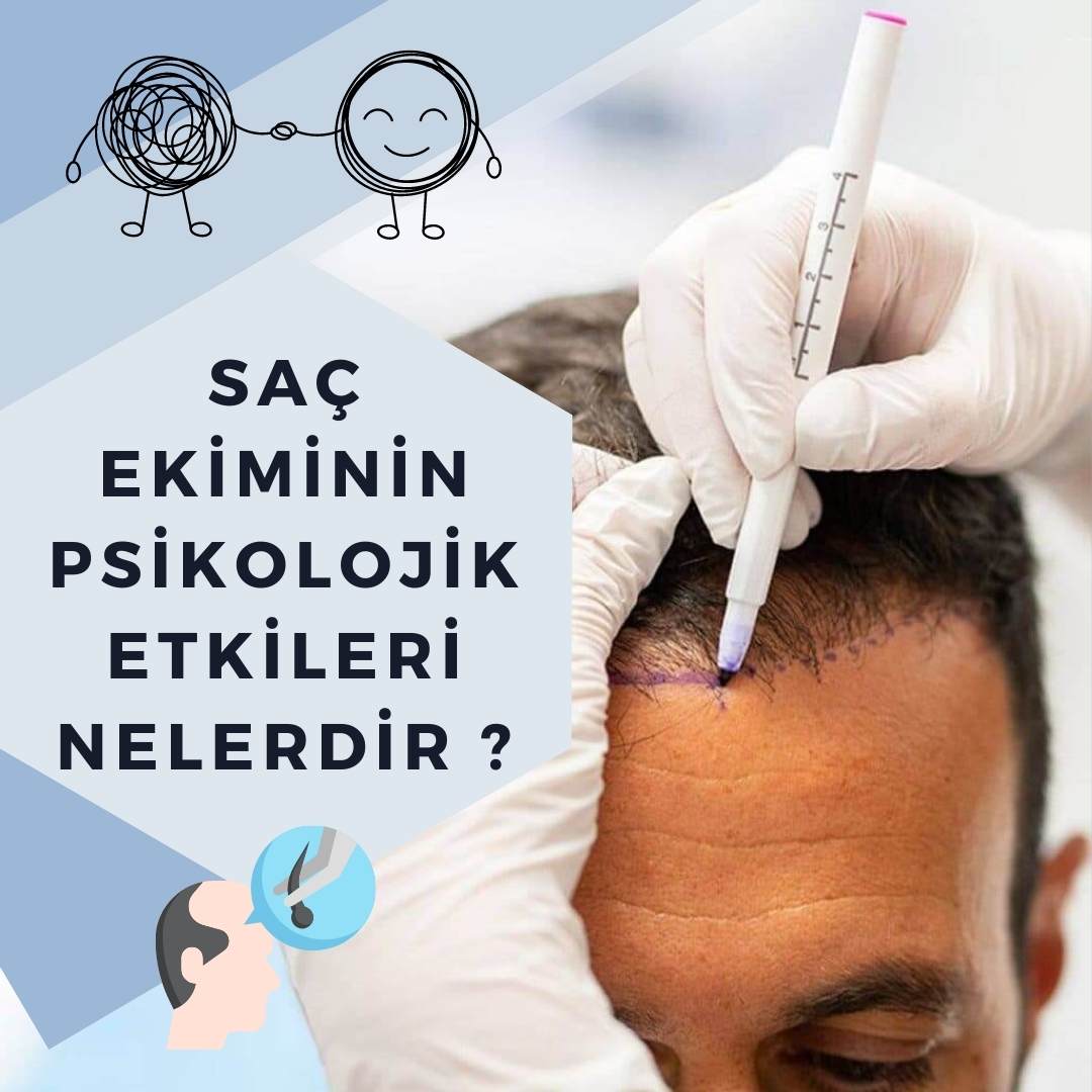 Saç Ekiminin Psikolojik Etkileri Nelerdir?