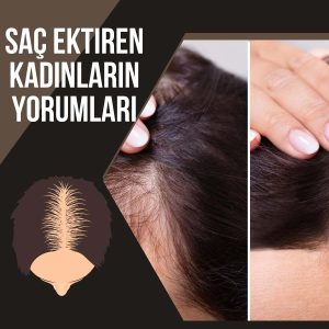 Saç Ektiren Kadınların Yorumları