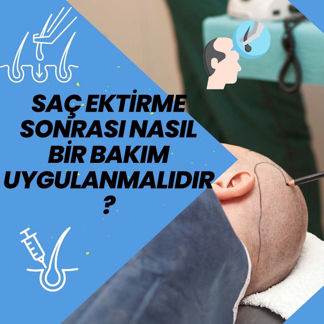 Saç Ektirme Sonrası Nasıl Bir Bakım Yapılmalıdır?