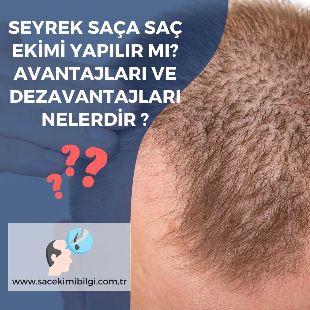 Seyrek Saça Saç Ekimi Yapılır mı? 2023