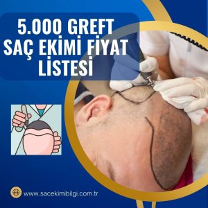 5000 Greft Saç Ekimi Fiyatı Listesi