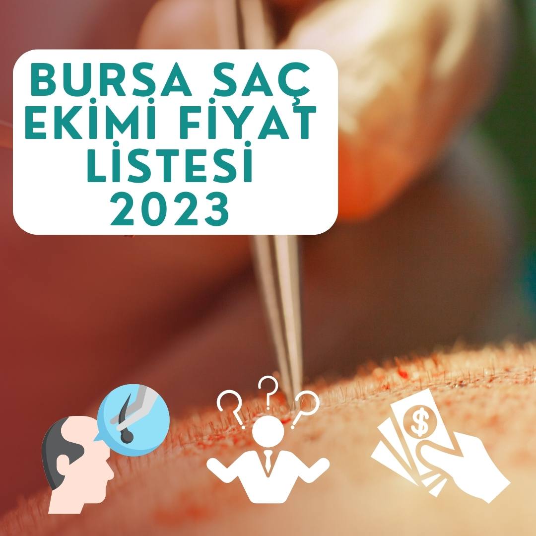 Bursa Saç Ekimi Fiyatları