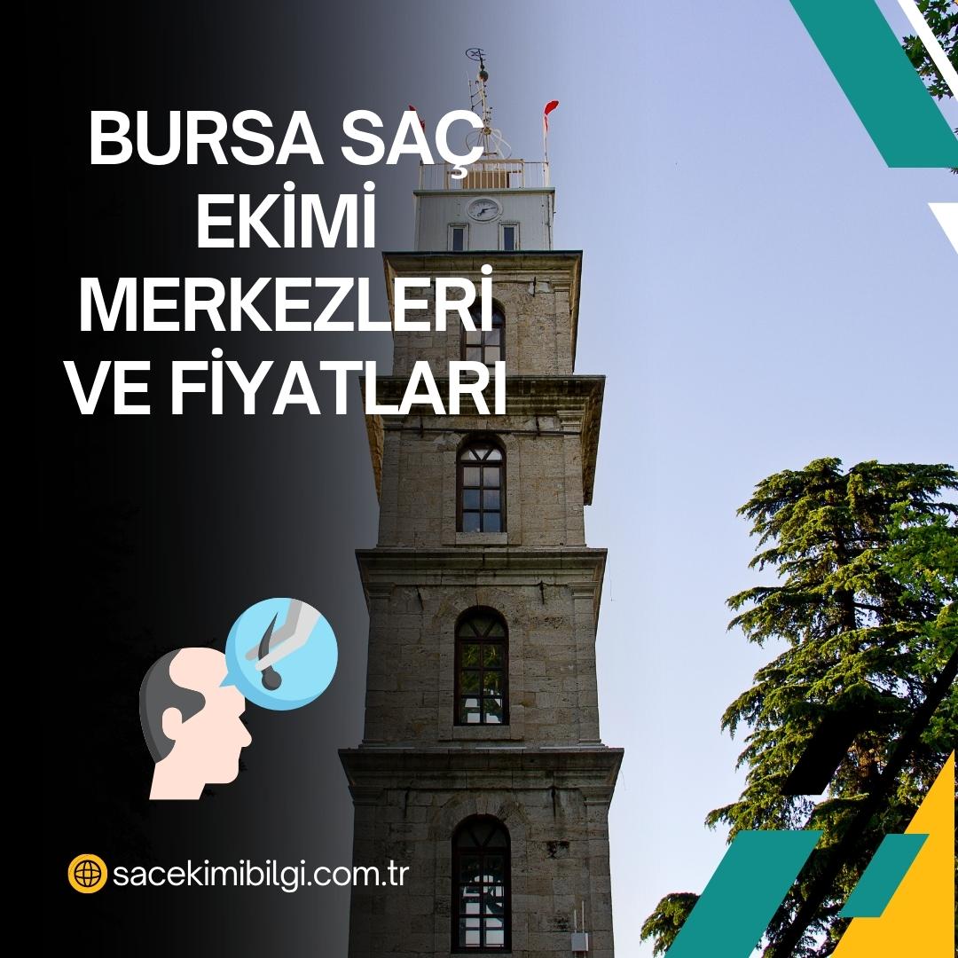 Bursa Saç Ekimi Merkezleri