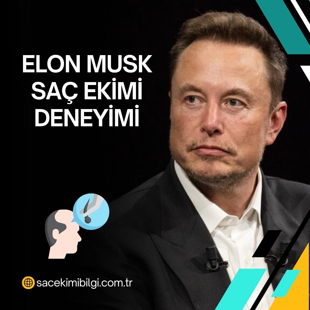 Elon Musk Saç Ekimi Deneyimi ve Yorumları