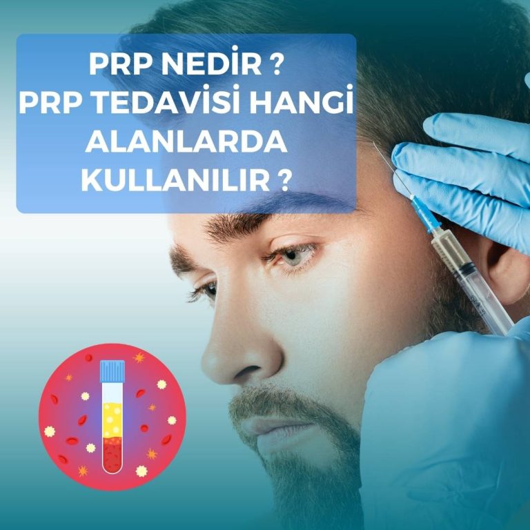 PRP Nedir ? PRP Tedavisi Kullanım Alanları