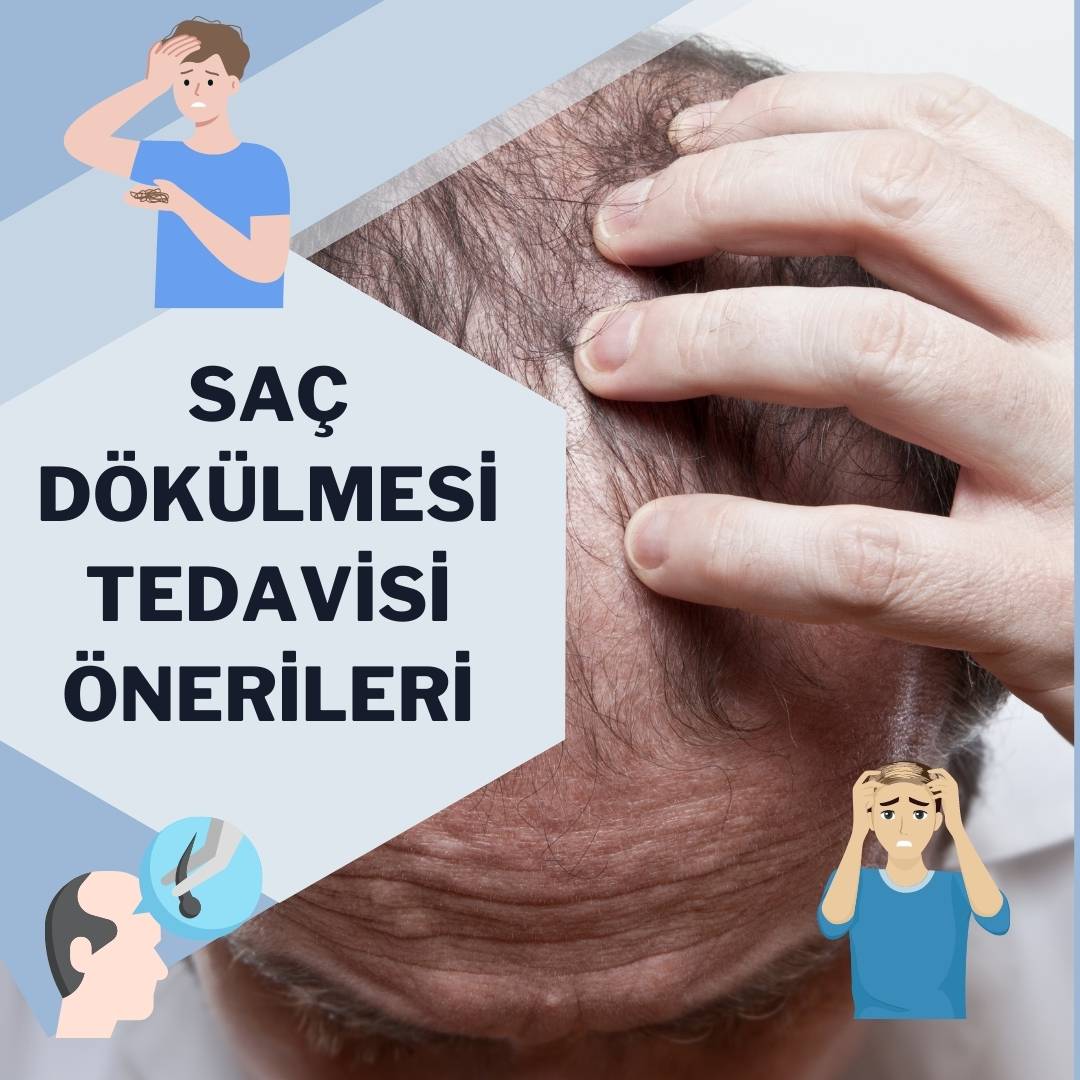 Saç Dökülmesi Tedavisi