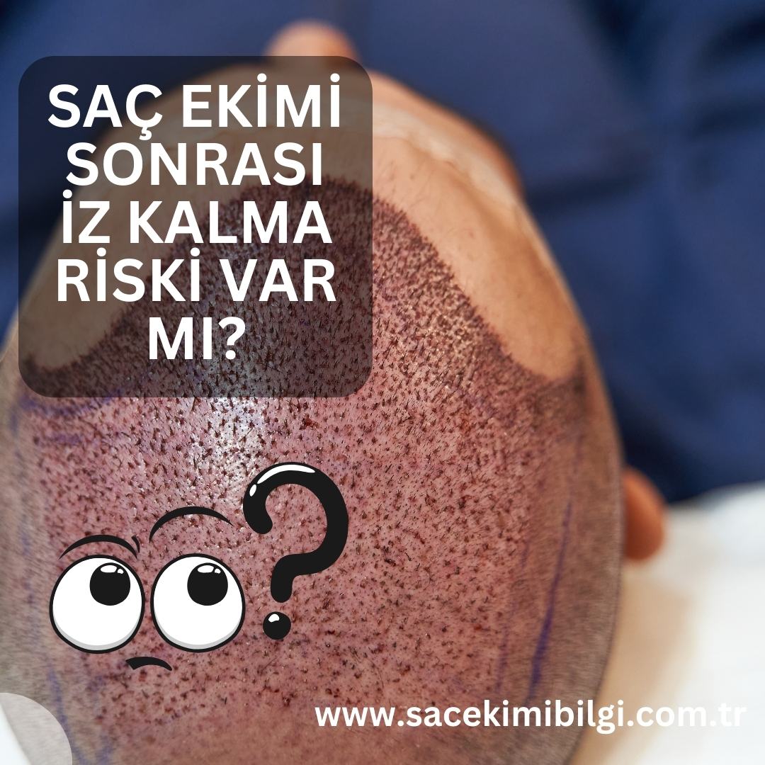 Saç Ekimi Ameliyatı Sonrası İz Kalma Riski Var Mı?