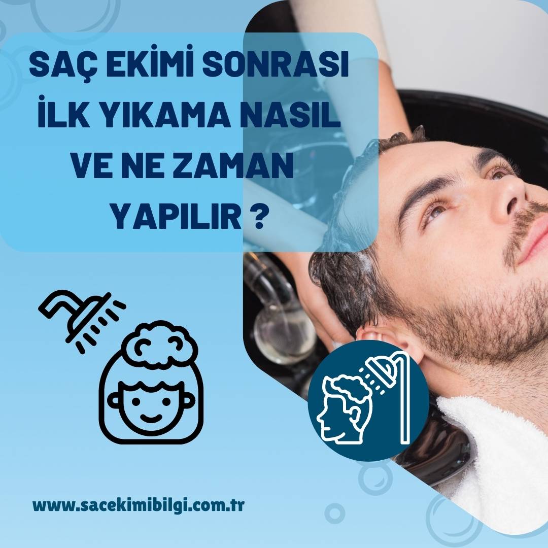 Saç Ekimi Sonrası İlk Yıkama Nasıl Yapılır ?