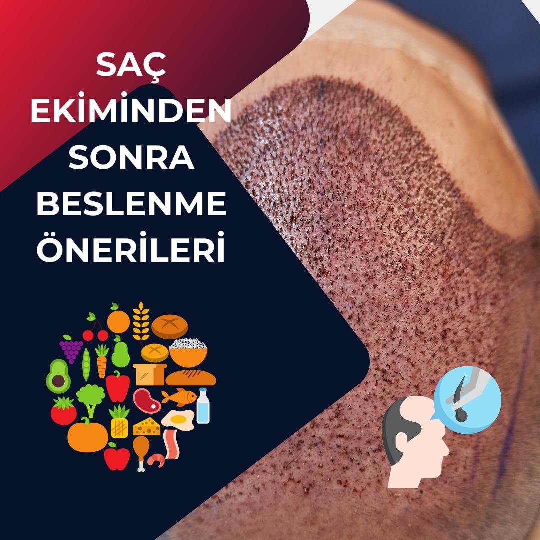 Saç Ekiminden Sonra Beslenme Önerileri