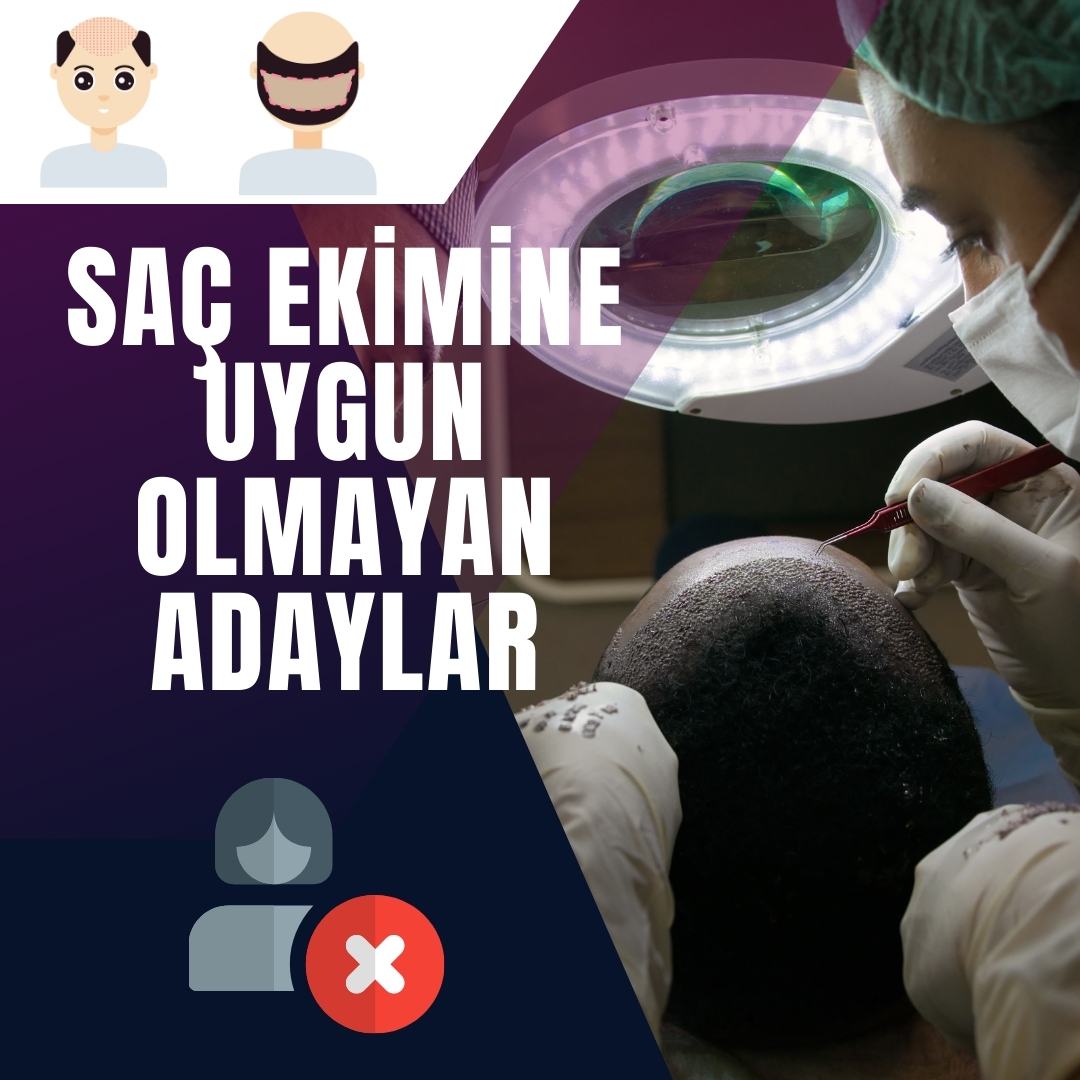 Saç Ekimine Uygun Olmayan Adaylar?