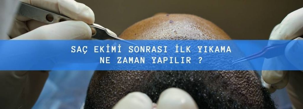 Saç Ekimi Sonrası İlk Yıkama Ne Zaman Yapılır ?