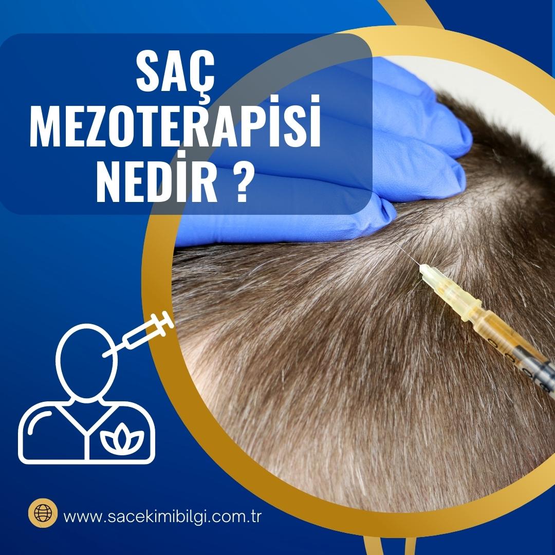 Saç Mezoterapisi Nedir ? Nasıl Uygulanır ?