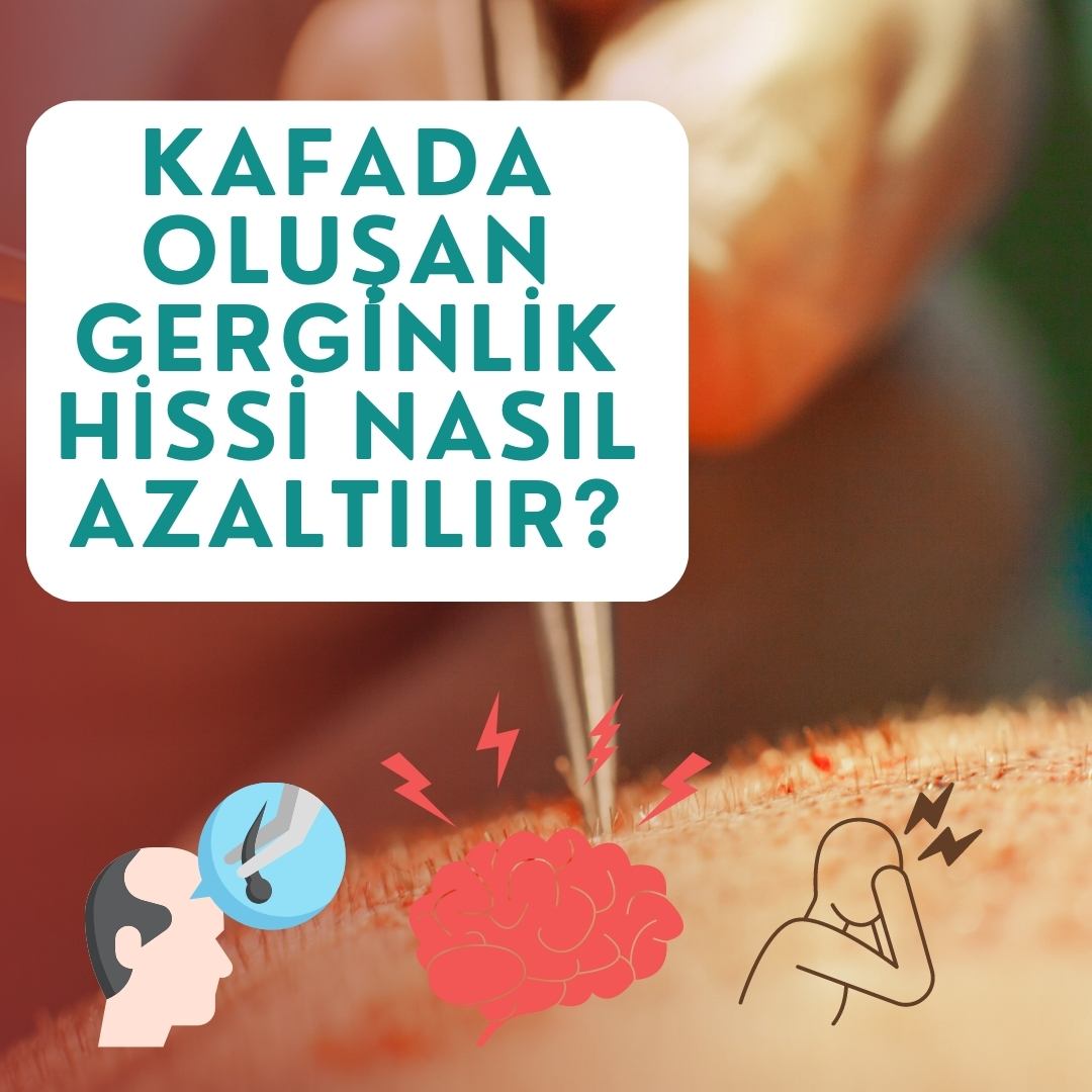 Saç Ekiminde Kafada Oluşan Gerginlik Hissi Azaltılır mı?