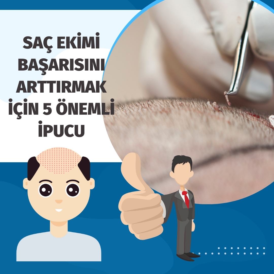 Saç Ekimi Başarısını Arttırmak İçin 5 Önemli İpucu