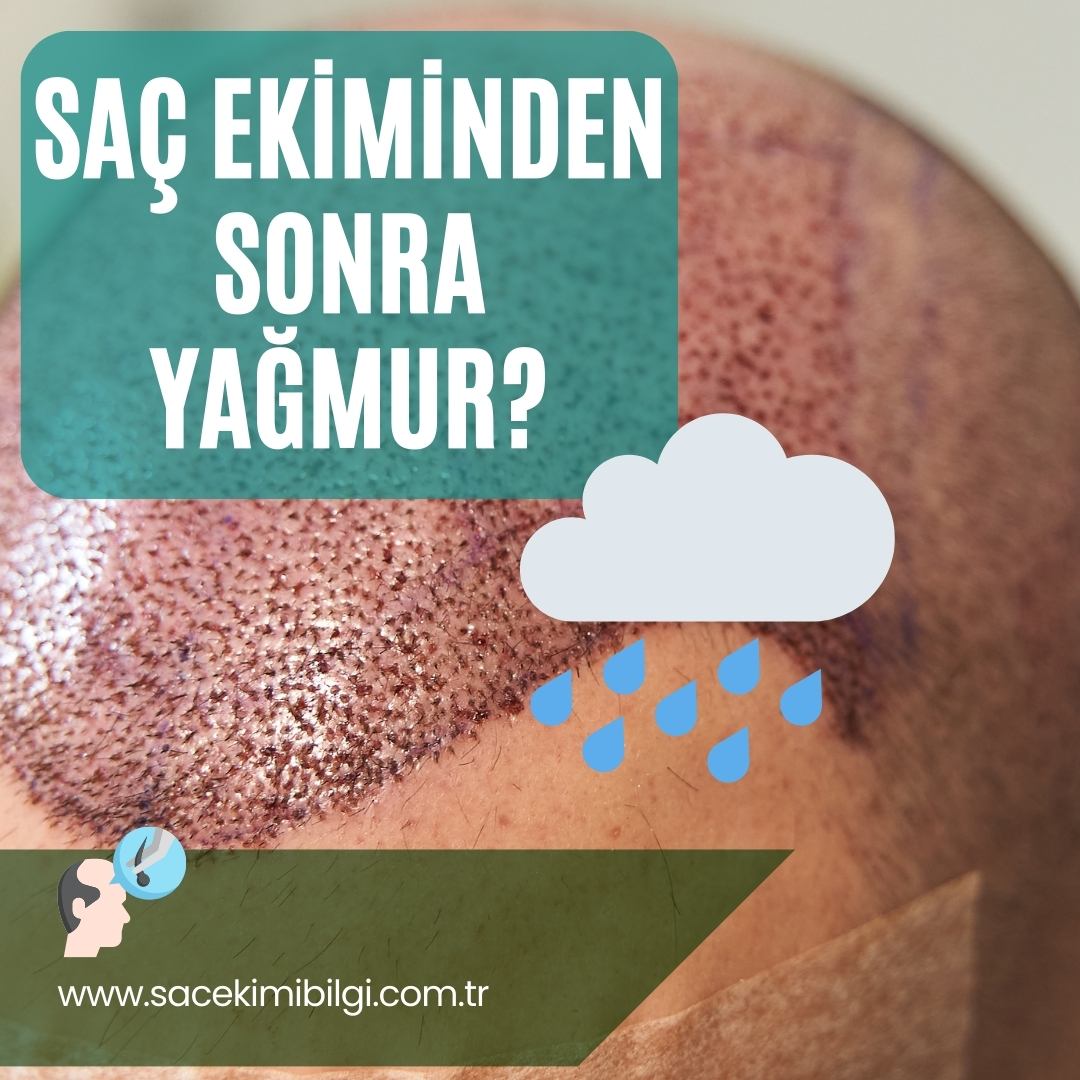 Saç Ekiminden Sonra Yağmur Zarar Verir mi?