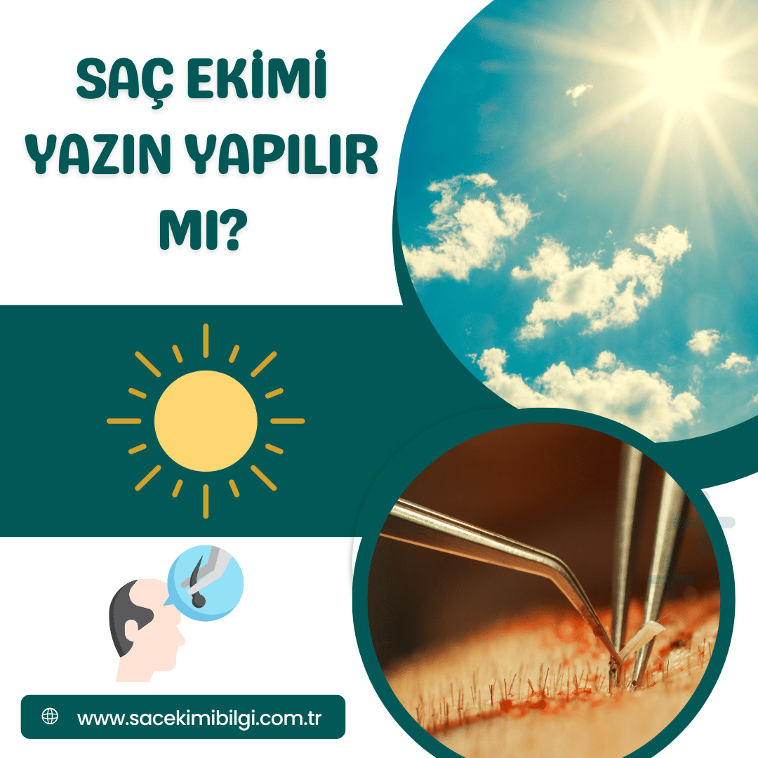 Saç Ekimi Yazın Yapılır mı?