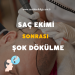 Saç Ekimi Sonrası Şok Dökülme