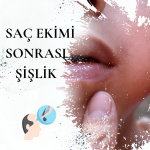 Saç Ekimi Sonrası Yüzde Şişlik