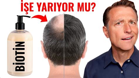 Saç Dökülmesi İlaçları İşe Yarıyor Mu?