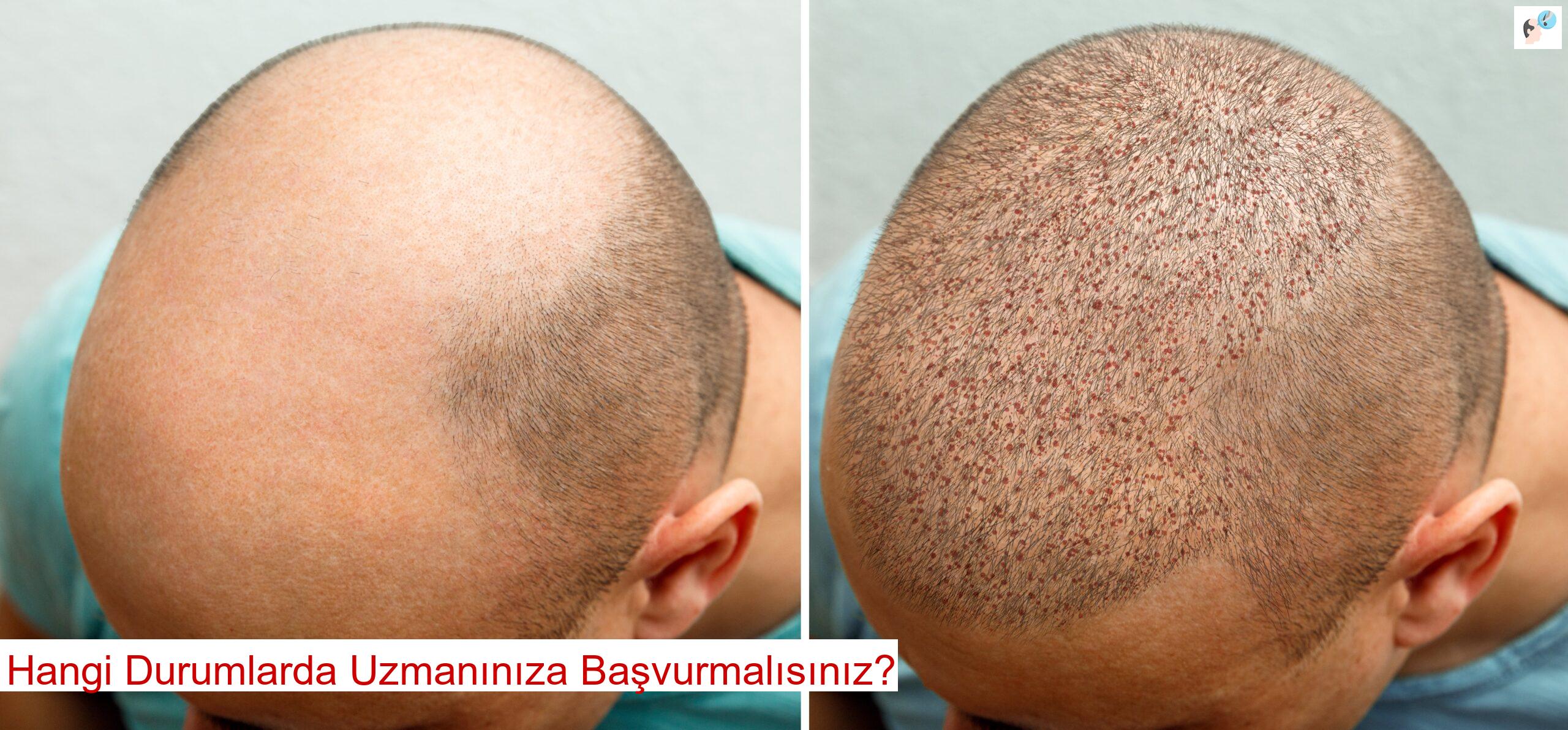 Hangi Durumlarda Uzmanınıza Başvurmalısınız?