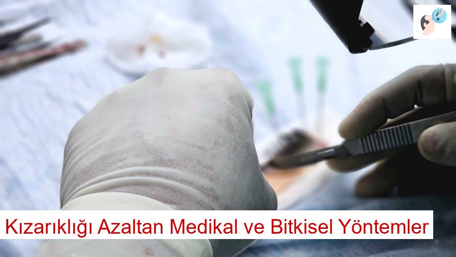 Kızarıklığı Azaltan Medikal ve Bitkisel Yöntemler