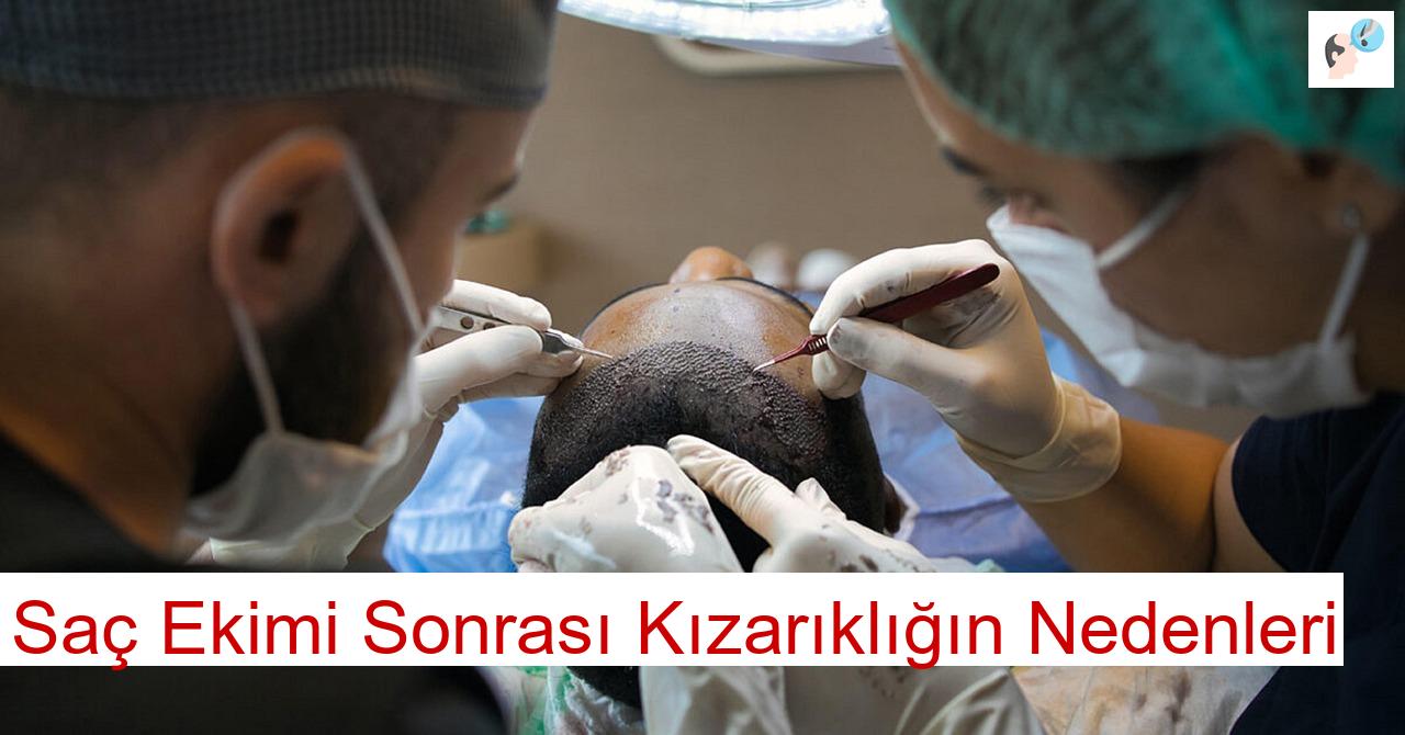 Saç Ekimi Sonrası Kızarıklığın Nedenleri